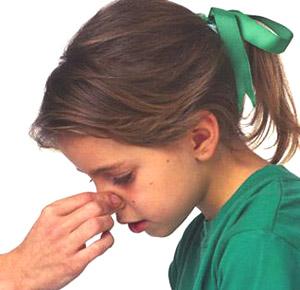 孩子经常鼻出血是什么原因